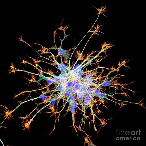Actin Art Print featuring the photograph Neurons From Stem Cells #4 by Dr Torsten Wittmann/science Photo Library