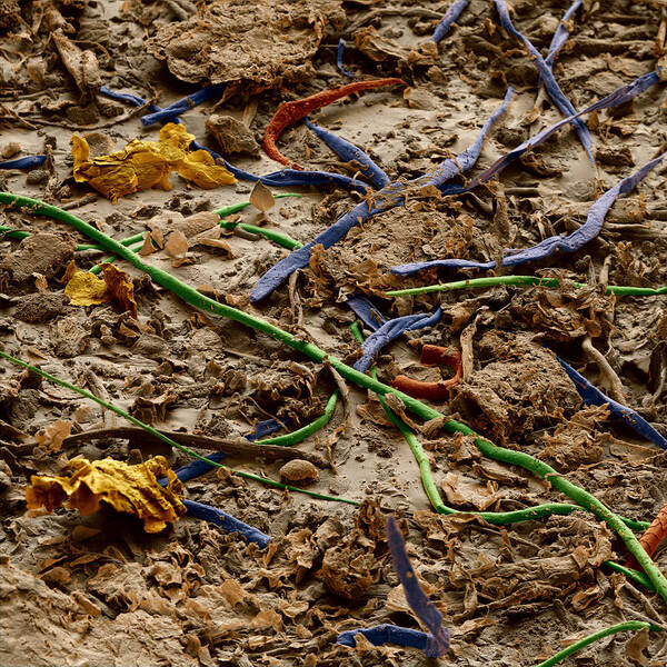 Allergen Art Print featuring the photograph Allergens In Household Dust by Meckes/ottawa