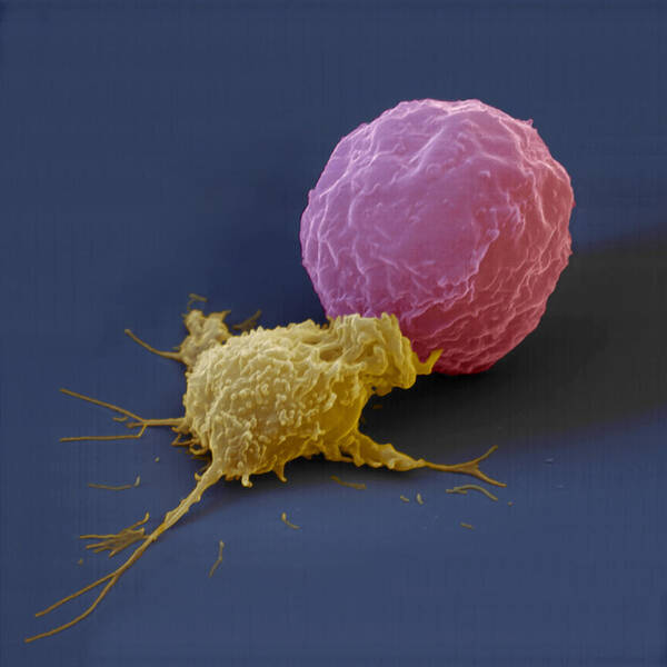 Antigen Art Print featuring the photograph Killer Cell And Cancer Cell by Meckes/ottawa
