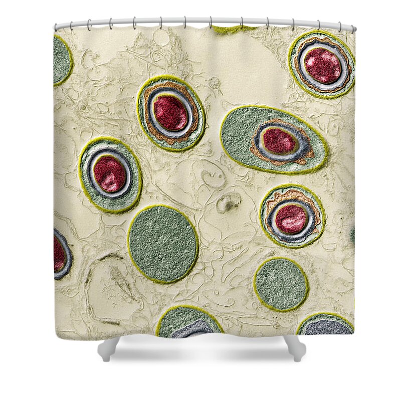 Bacteria Shower Curtain featuring the photograph Anthrax Bacteria, Bacillus Anthracis #1 by Eye of Science