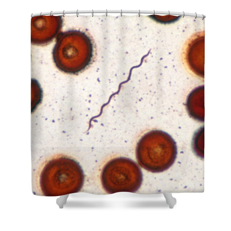 Bacteria Shower Curtain featuring the photograph Borrelia Burgdorferi Lm #1 by Michael Abbey