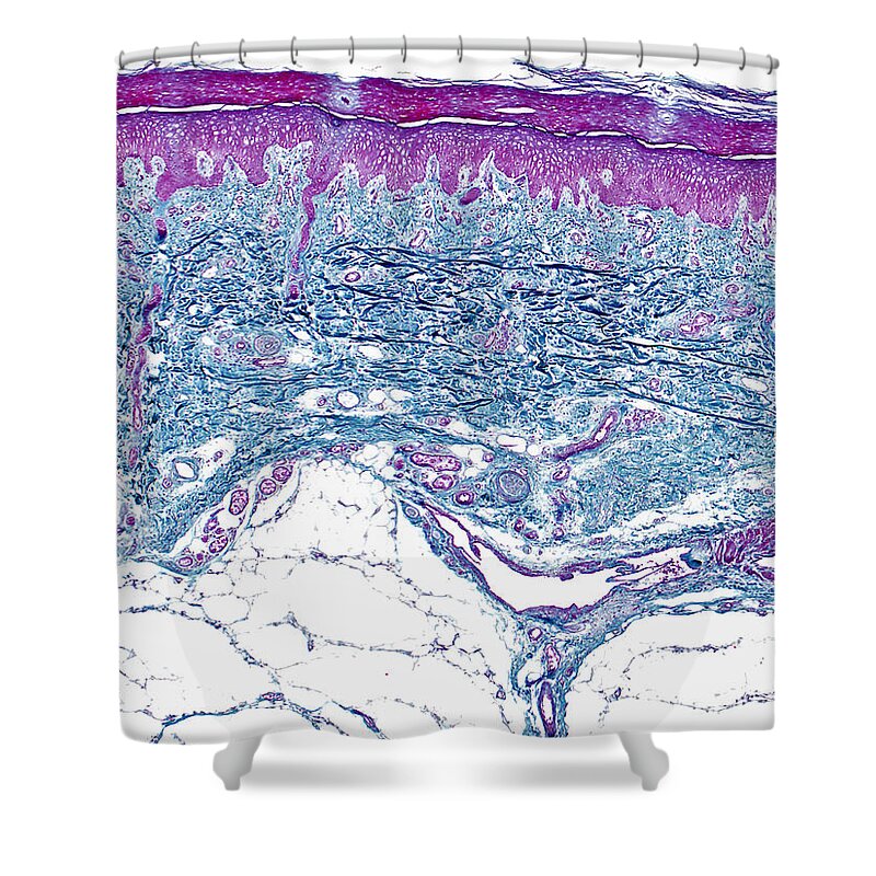Skin Shower Curtain featuring the photograph Skin Lm #12 by Alvin Telser