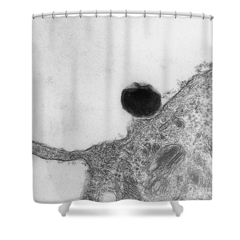 Science Shower Curtain featuring the photograph Chlamydia On Oviduct Surface, Tem #2 by David M. Phillips