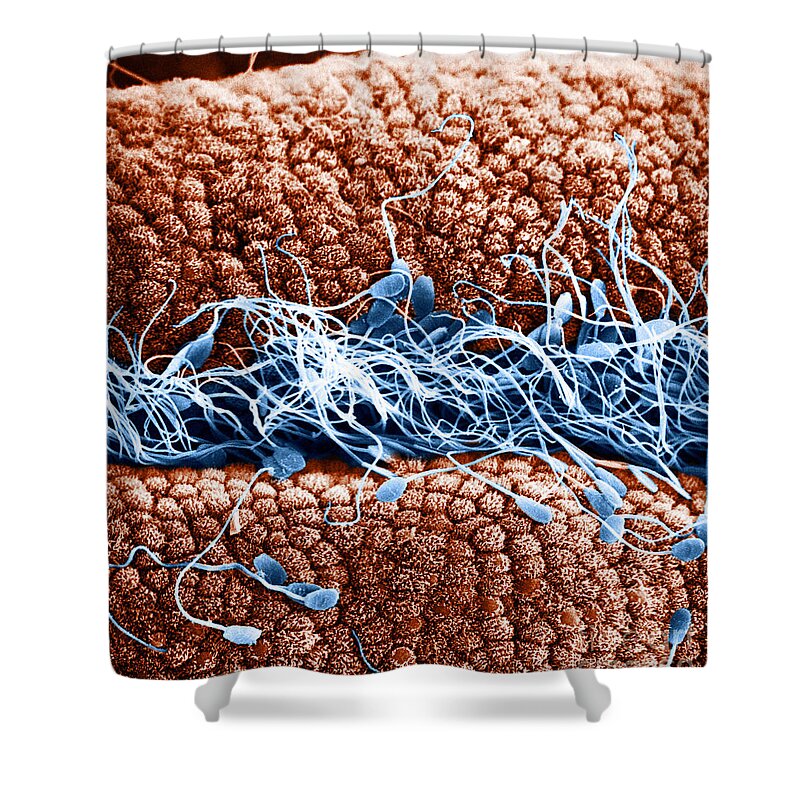 Scanning Electron Micrographs Shower Curtain featuring the photograph Sperm On Oviduct Surface, Sem #2 by David M. Phillips