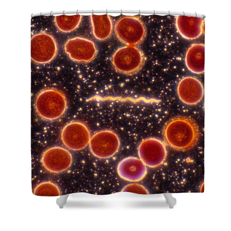 Bacteria Shower Curtain featuring the photograph Borrelia Burgdorferi, Lm by Michael Abbey