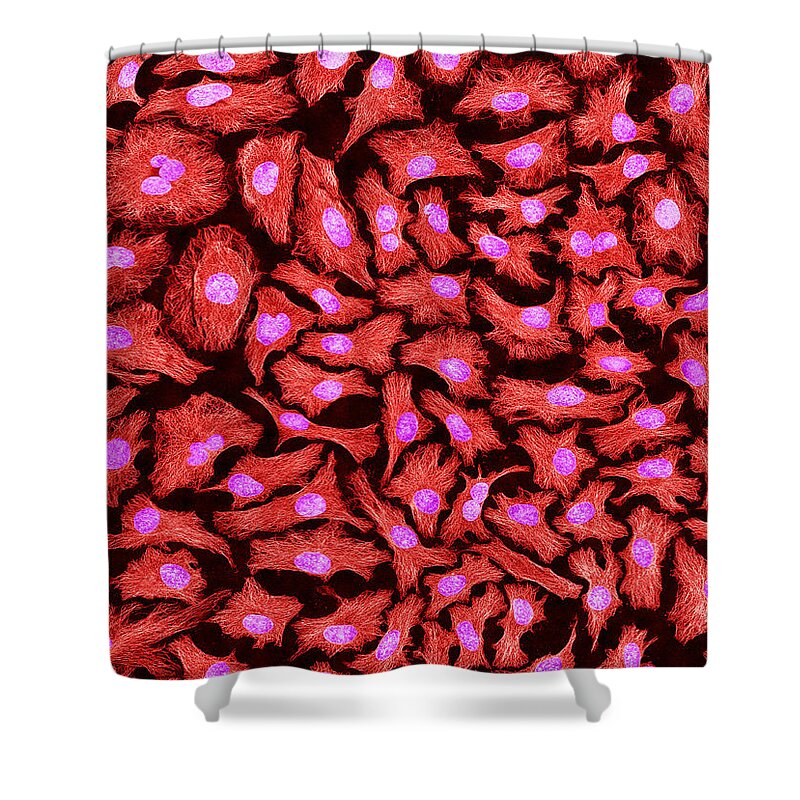 Science Shower Curtain featuring the photograph Hela Cells, Mfm #4 by Science Source