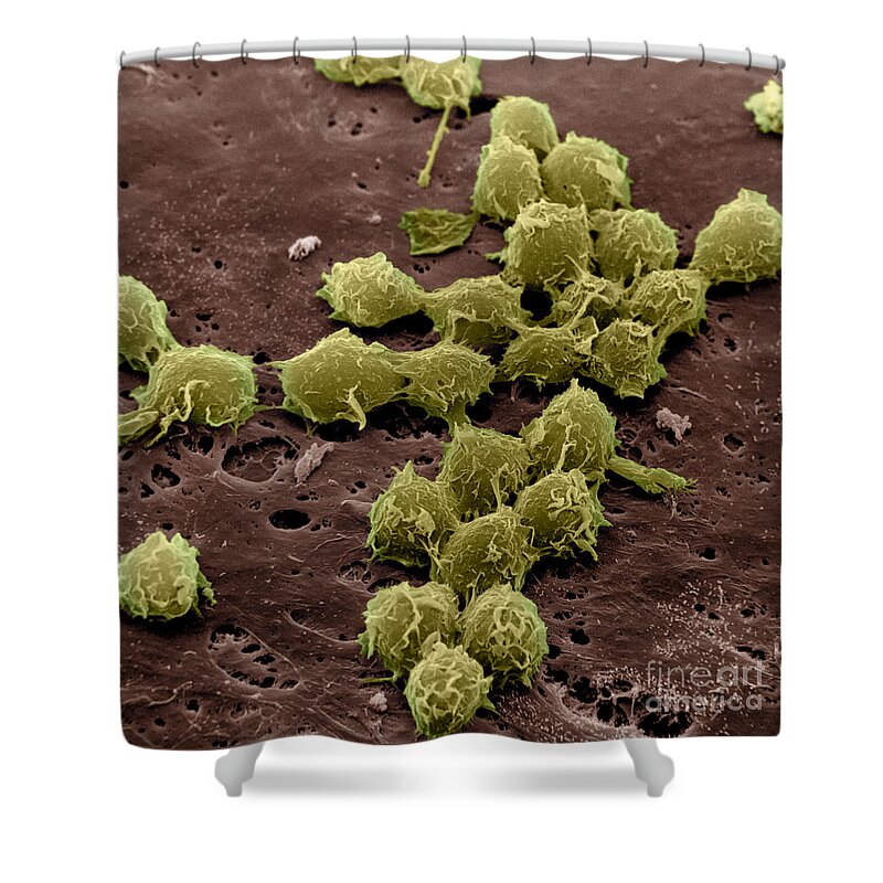 Scanning Electron Micrograph Shower Curtain featuring the photograph Macrophages On The Surface #4 by David M. Phillips