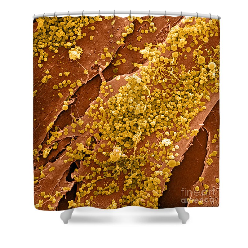 Cell Shower Curtain featuring the photograph Human Skin Cell Sem by David M. Phillips