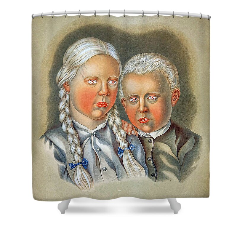 Science Shower Curtain featuring the photograph Albino Children 19th Century by Science Source
