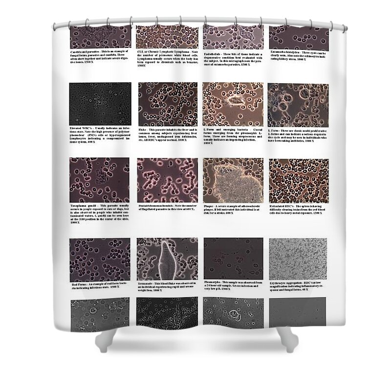 Blood Shower Curtain featuring the photograph Blood cells by Hugh Smith