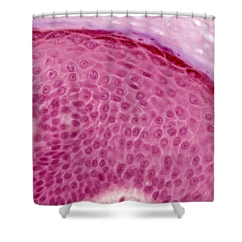 Skin Shower Curtain featuring the photograph Epidermis Lm by Alvin Telser