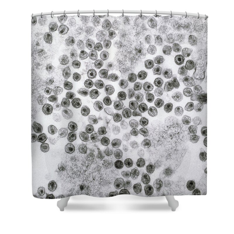 Hiv Shower Curtain featuring the photograph Hiv Virus by David M. Phillips