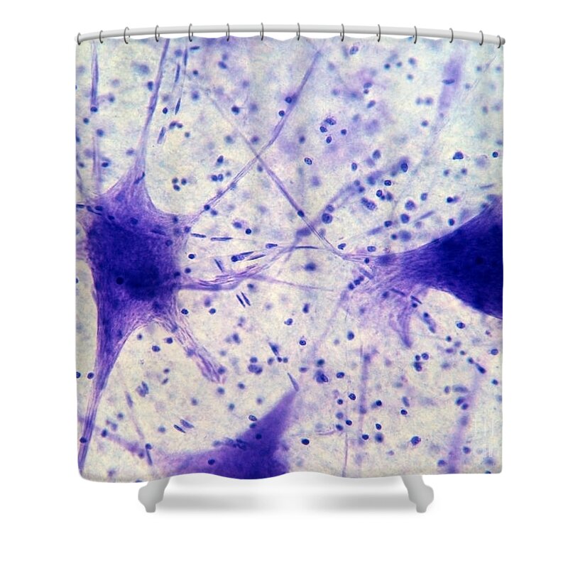 Nerve Shower Curtain featuring the photograph Pig Motor Nerve by Garry DeLong