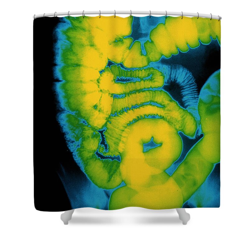 Barium X-ray Shower Curtain featuring the photograph X-ray Of Large Intestine by Susan Leavines