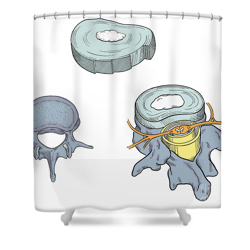 Anatomy Shower Curtain featuring the photograph Illustration Of Spinal Disks #4 by Science Source