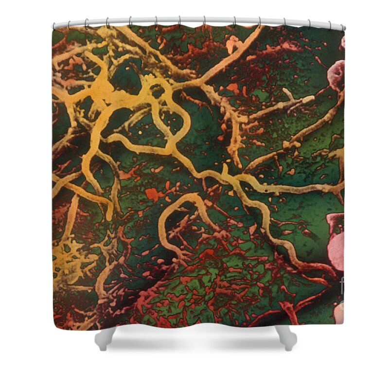 Science Shower Curtain featuring the photograph Lyme Disease Sem #1 by Science Source