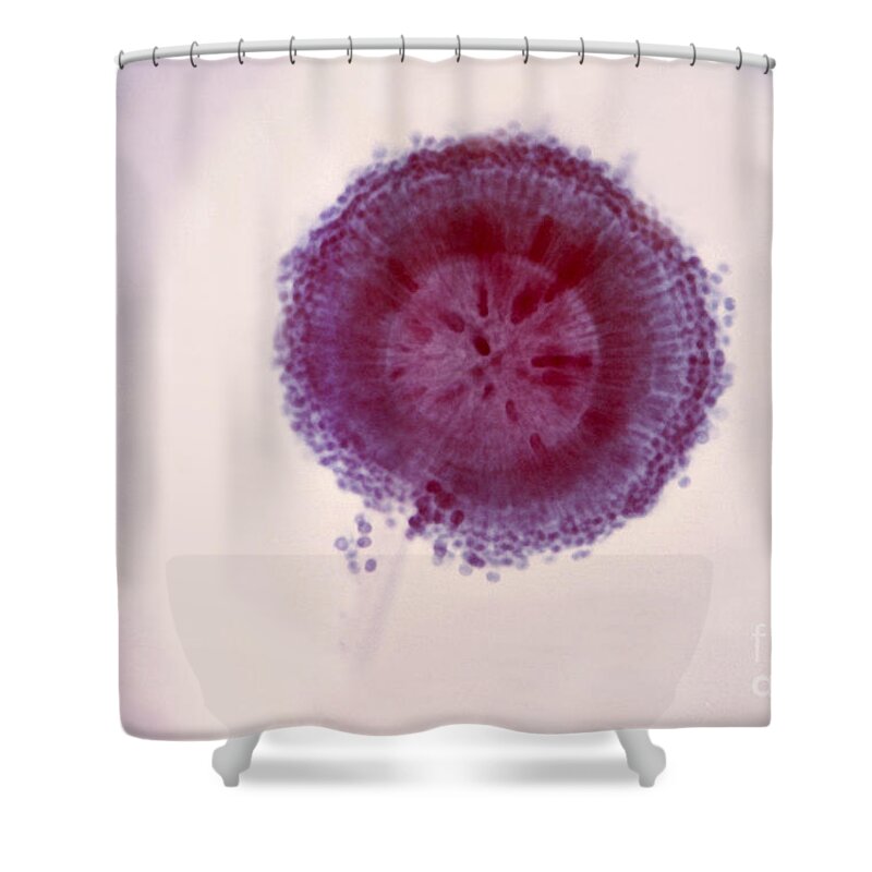 Micrograph Shower Curtain featuring the photograph Aspergillus Niger by Science Source