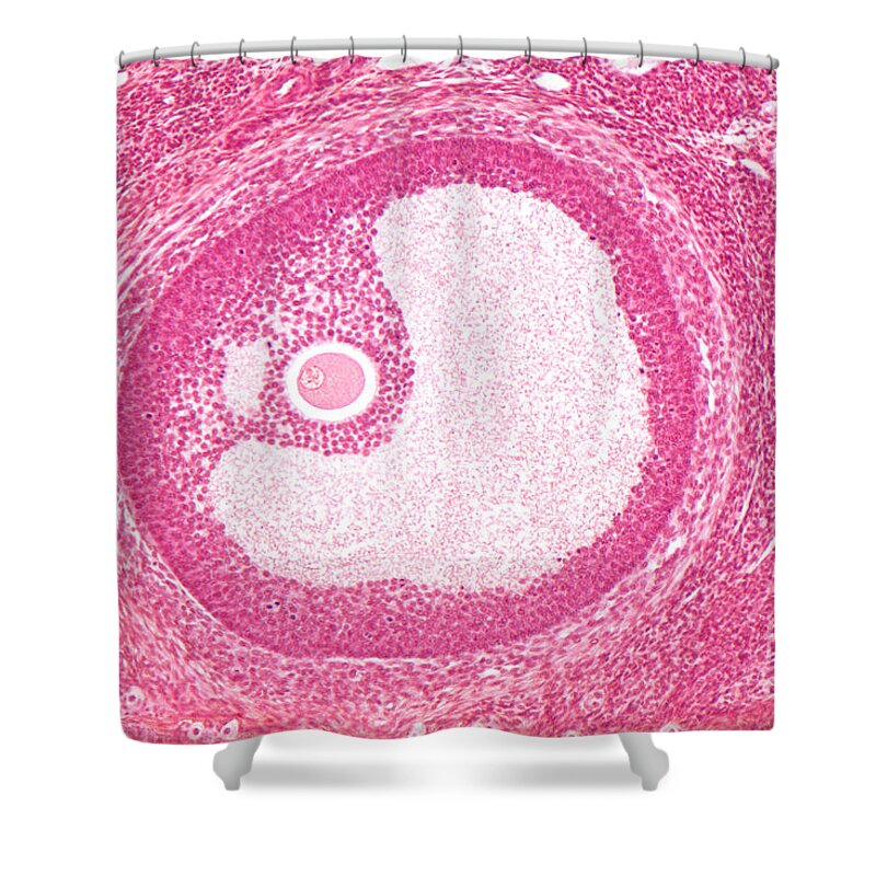 Histology Shower Curtain featuring the photograph Mature Graafian Follicle, Mouse Ovary by M. I. Walker