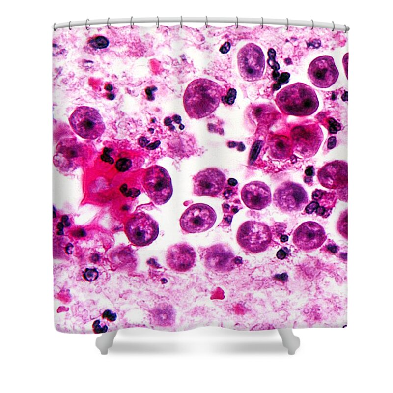 Micrograph Shower Curtain featuring the photograph Naegleria Fowleri, Lm by Science Source