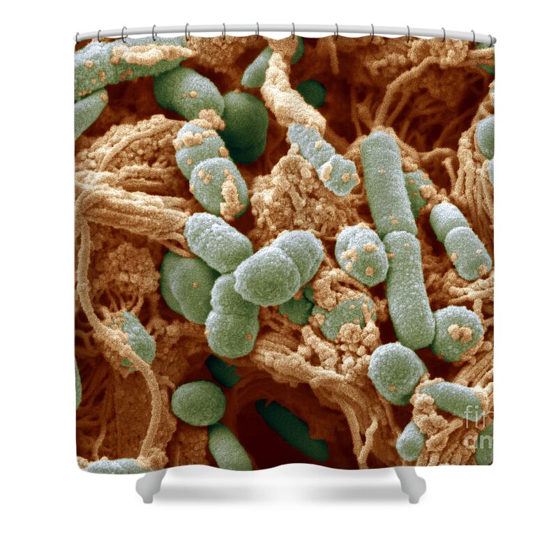 Chicken Skin Shower Curtain featuring the photograph Chicken Skin Contaminated With Bacteria #1 by Scimat