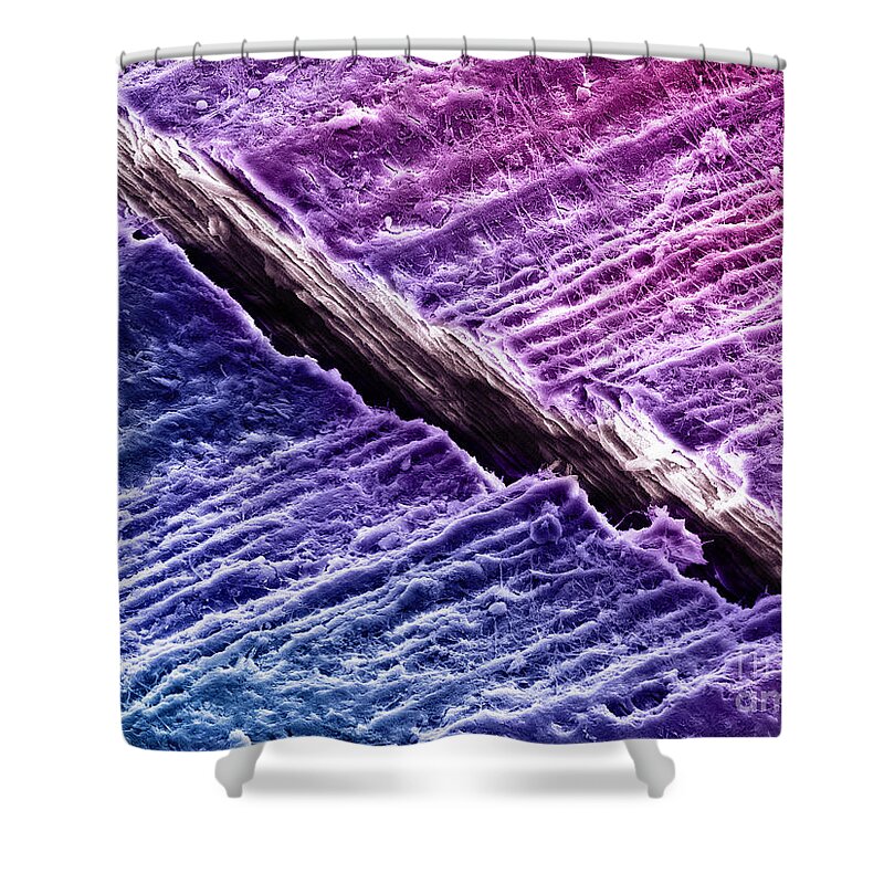 Dentine Shower Curtain featuring the photograph Human Tooth Dentine, Sem #4 by Ted Kinsman