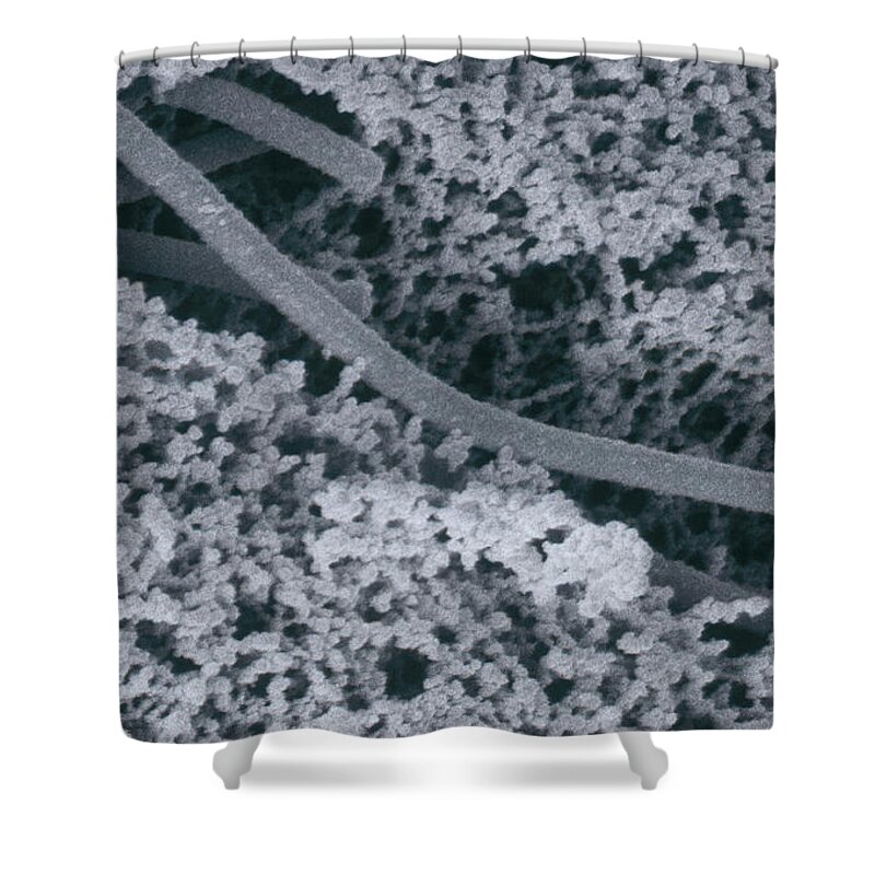 Streptococcus Thermophilus Shower Curtain featuring the photograph Bacteria In Yogurt #2 by Scimat