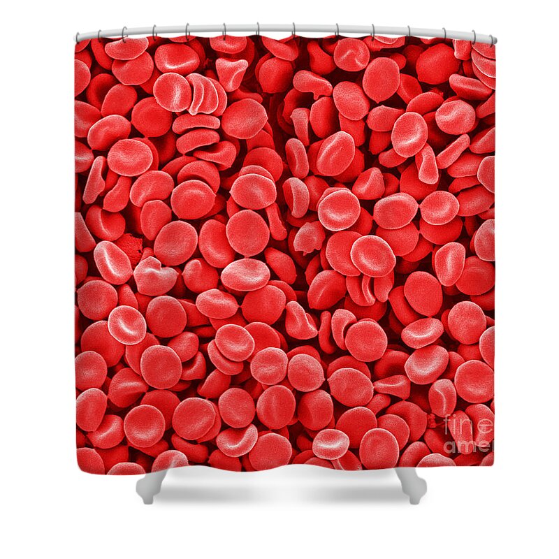 Red Blood Cells Shower Curtain featuring the photograph Red Blood Cells, Sem #4 by Scimat