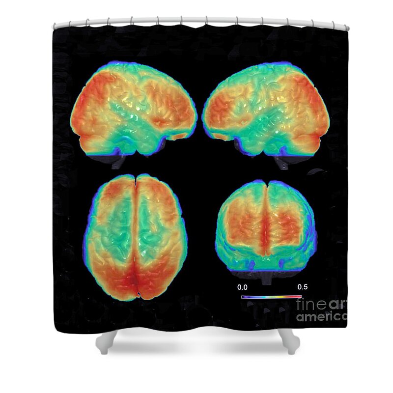 Science Shower Curtain featuring the photograph Bipolar Brain, 3d Mri Scan by Science Source