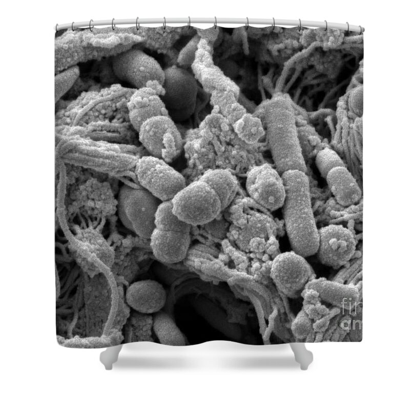 Chicken Skin Shower Curtain featuring the photograph Chicken Skin Contaminated With Bacteria by Scimat