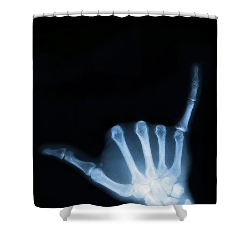 X-ray Shower Curtain featuring the photograph Hang Loose by Gravityx9 Designs