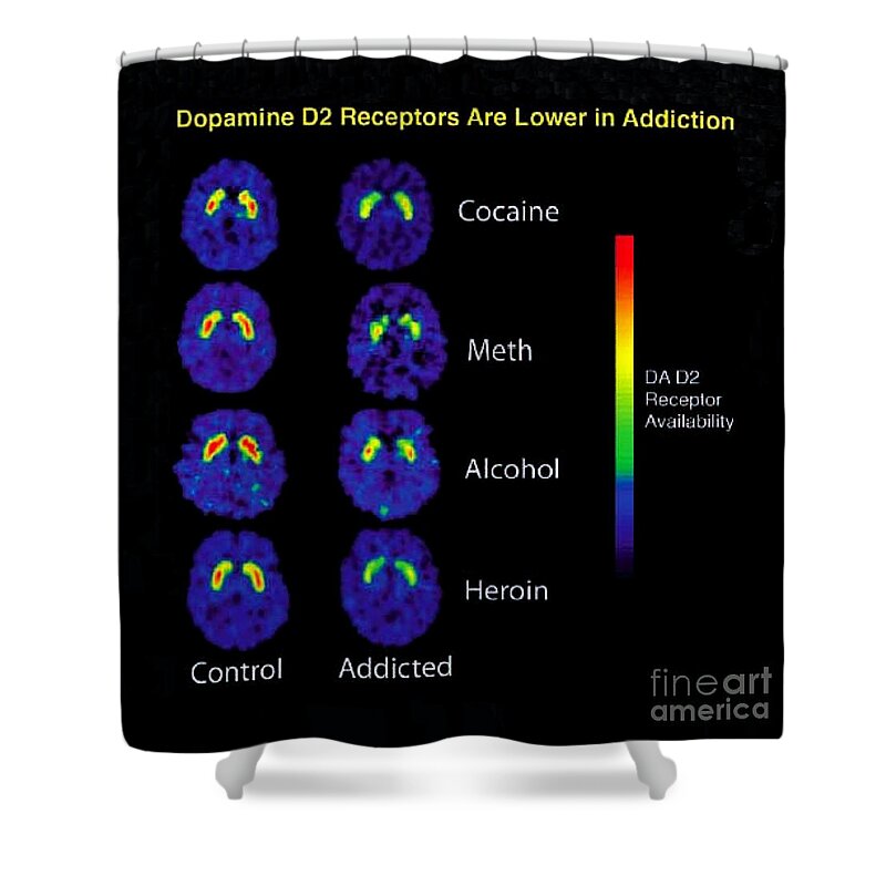 Science Shower Curtain featuring the photograph Healthy And Addicted Brains, Pet Scans by Science Source