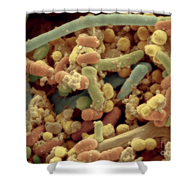 Cocci Shower Curtain featuring the photograph Streptococcus Pyogenes by Scimat