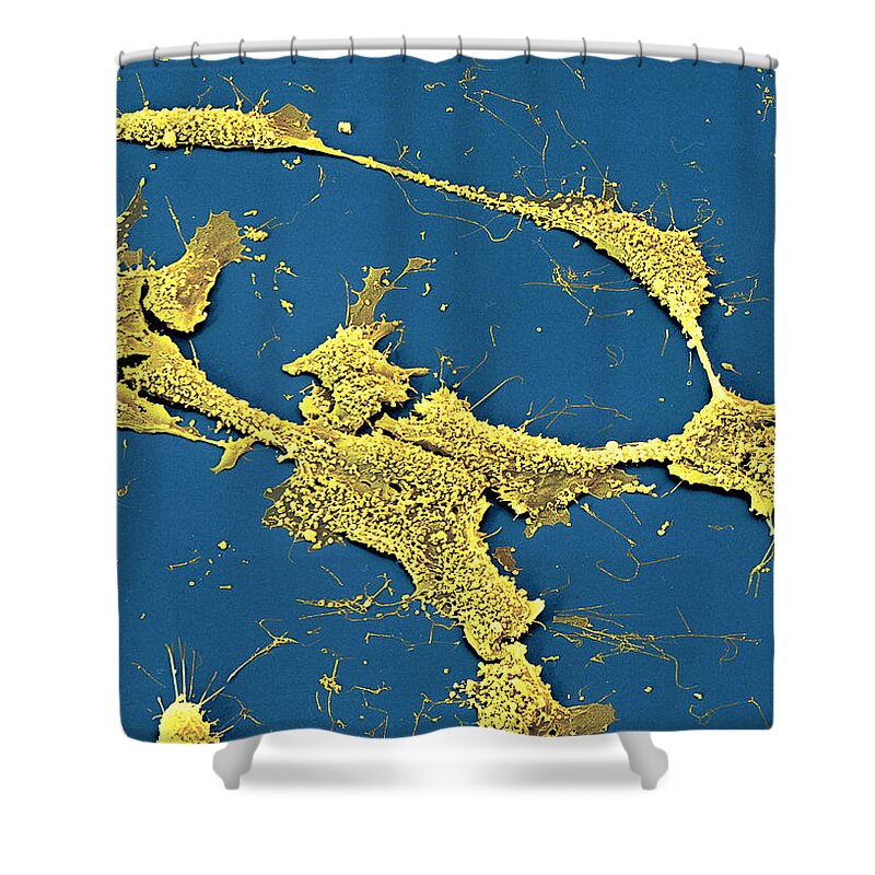 Cancer Shower Curtain featuring the photograph Neuroblastoma Cells #1 by Meckes/ottawa
