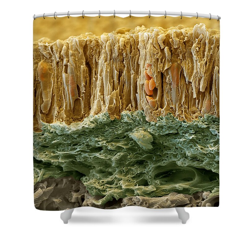 Algae Shower Curtain featuring the photograph Common Orange Lichen #2 by Meckes/ottawa