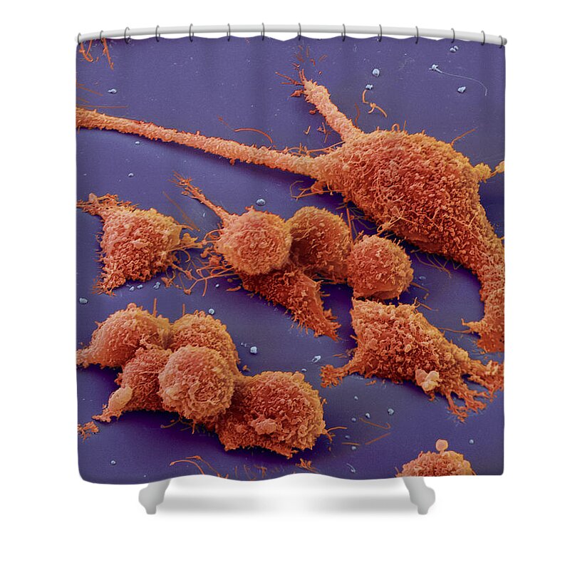 Cancer Shower Curtain featuring the photograph Colon Cancer #3 by Meckes/ottawa