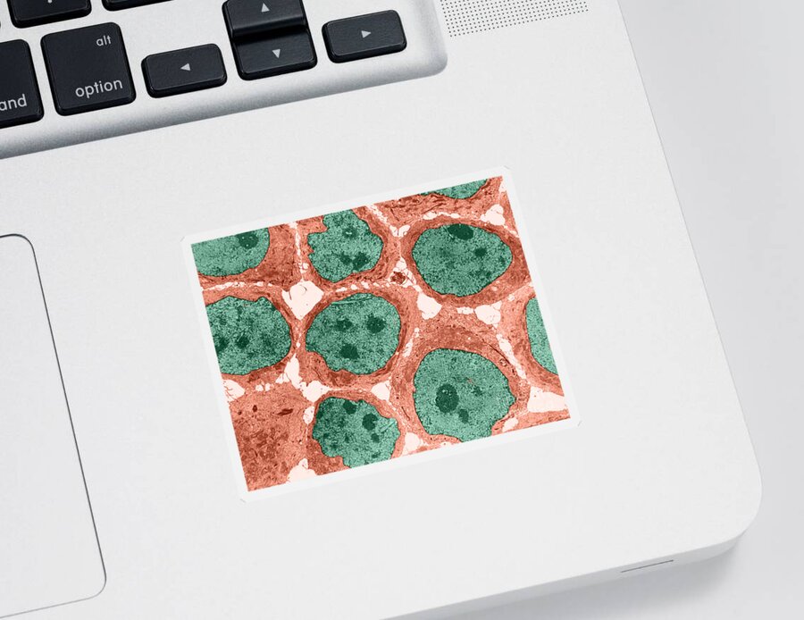 Science Sticker featuring the photograph Human Kb Cells Tem #1 by David M. Phillips
