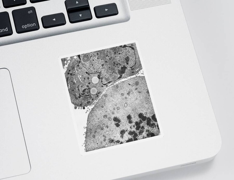 Science Sticker featuring the photograph Kb Cell Infected With Adenovirus Tem #1 by David M. Phillips