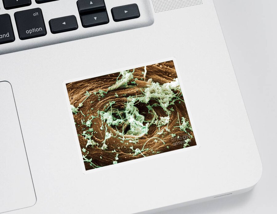 Sem Sticker featuring the photograph Bacteria On Skin #2 by David M. Phillips