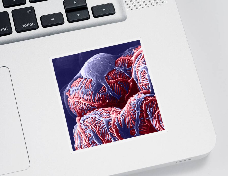 System Sticker featuring the photograph Kidney Glomerulus, Sem #3 by Don W Fawcett