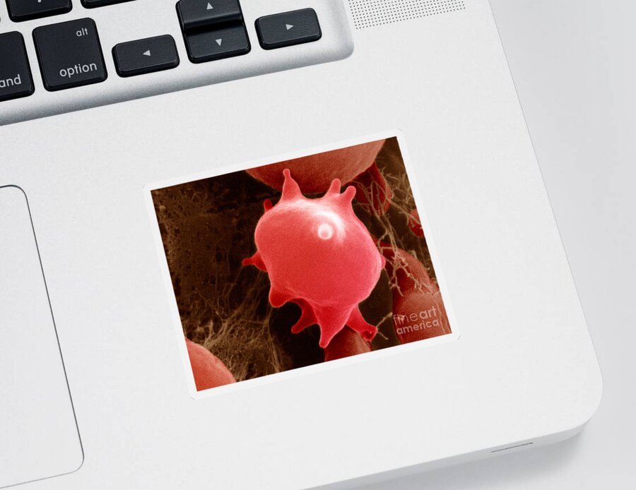 Cell Sticker featuring the photograph Red Blood Cell In Hypertonic Solution #2 by David M. Phillips