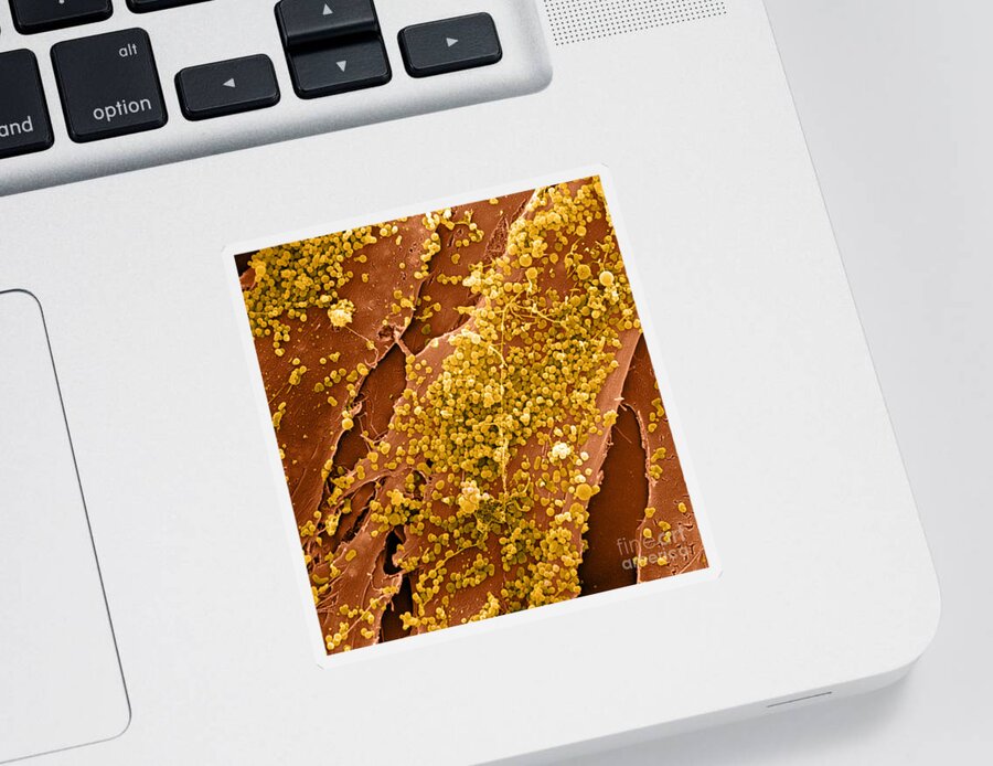 Cell Sticker featuring the photograph Human Skin Cell Sem by David M. Phillips