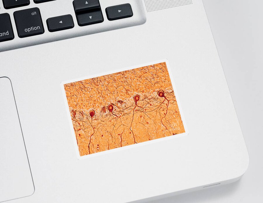 Cerebellum Sticker featuring the photograph Cerebellum by Biophoto Associates