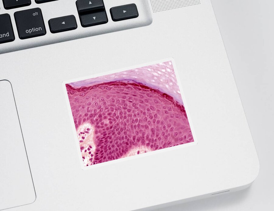 Skin Sticker featuring the photograph Epidermis Lm by Alvin Telser