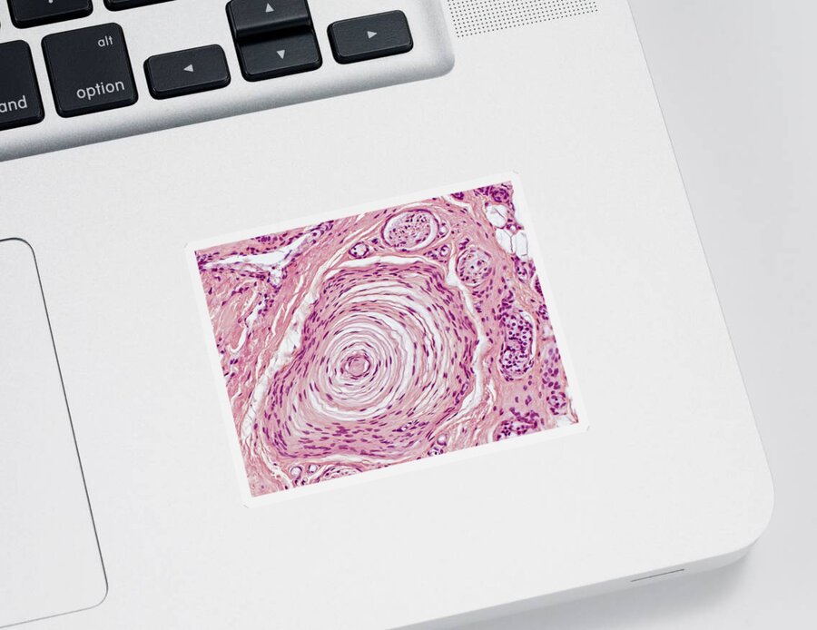 Pacinian Corpuscle Sticker featuring the photograph Pacinian Corpuscle Lm by Alvin Telser