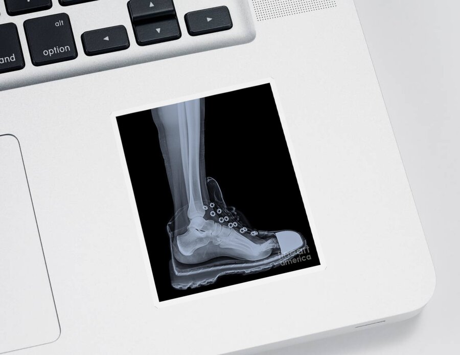 Ankle Sticker featuring the photograph running shoe X-Ray 4 by Guy Viner