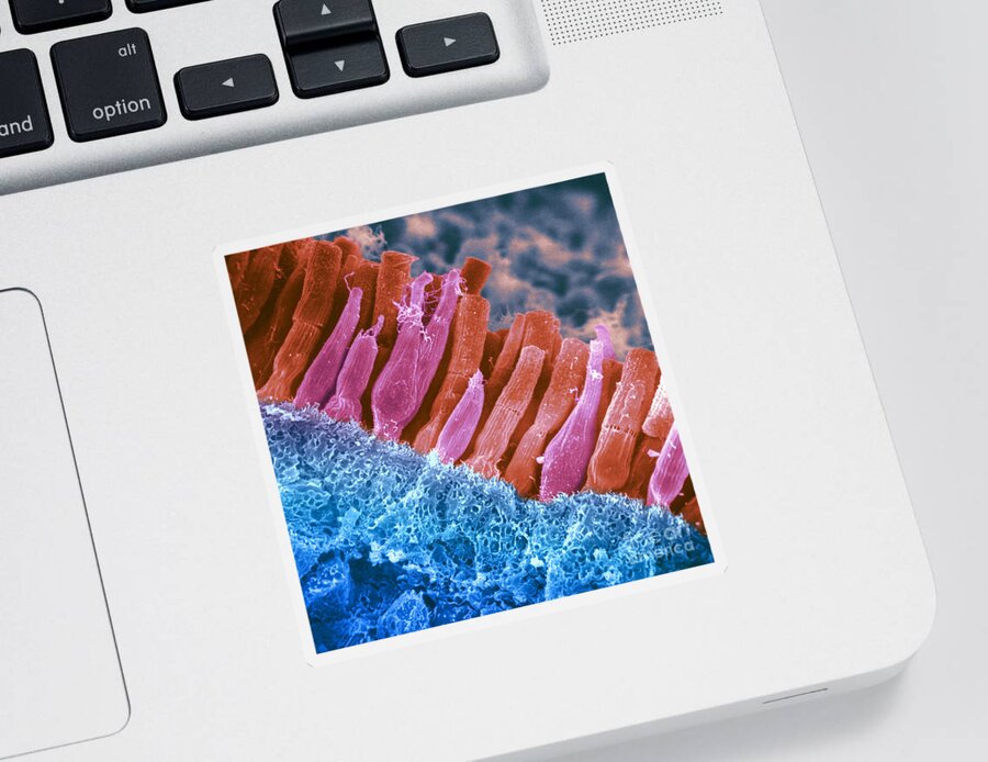 Scanning Electron Micrograph Sticker featuring the photograph Rods And Cones In Retina #3 by Omikron