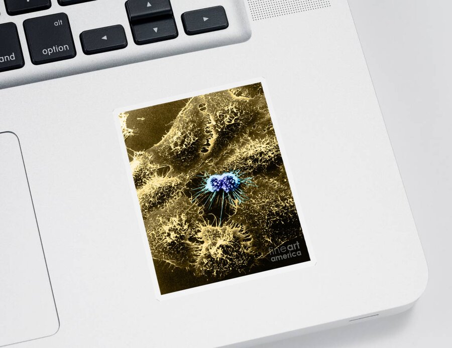 Sem Sticker featuring the photograph Hela Cells With Adenovirus #4 by Science Source