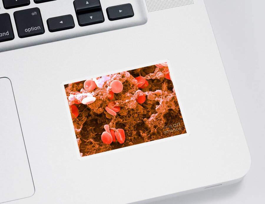 Biology Sticker featuring the photograph Red Blood Cells, Sem #6 by Science Source