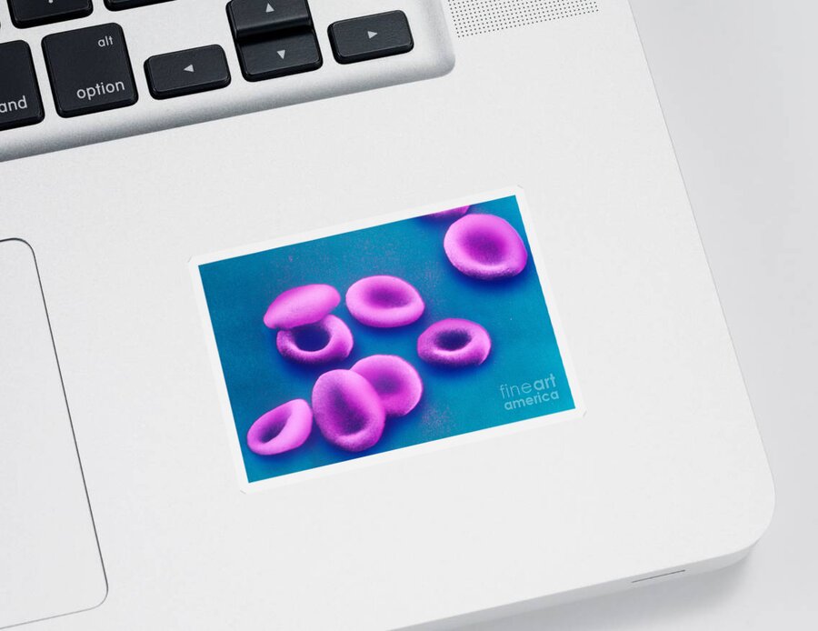 Corpuscle Sticker featuring the photograph Red Blood Cells, Sem #7 by Omikron
