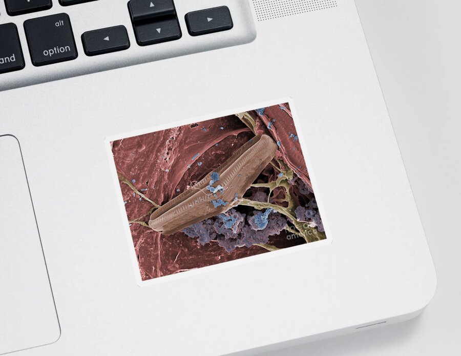 Bacteria Sticker featuring the photograph Diatom With Thermophilic Bacteria by Ted Kinsman